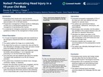 Nailed! Penetrating Head Injury in a 19-Year-Old Male by Brode Breuker, Jason Seamon, and Tiffany Fleeger