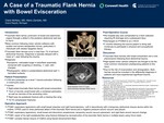 A Case of a Traumatic Flank Hernia with Bowel Evisceration