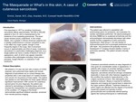 The Masquerade or What's in This Skin; A Case of Cutaneous Sarcoidosis by Daniel Emrick and Anacleto Diaz