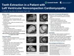 Teeth Extraction in a Patient with Left Ventricular Noncompaction Cardiomyopathy by Cecilia Li, Dalton King, and Phillip Muellerleile
