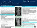 Serendipitous X-Rays: Back-to-Back Incidental Findings of Congenital Diaphragmatic Hernia and Congenital Neuroblastoma on Routine Neonatal XR by Geralyn Moody