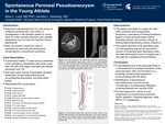 Spontaneous Peroneal Pseudoaneurysm in the Young Athlete by Nina Lund and Jennifer Hemberg