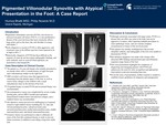 Pigmented Villonodular Synovitis with Atypical Presentation in the Foot: A Case Report by Humza Bhatti, Hussein Hazime, and Philip Nowicki