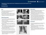 Management of Intercostal Artery Pseudoaneurysm after Stab Wound to Chest