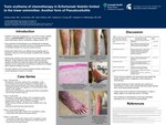 Toxic Erythema of Chemotherapy in Enfortumab Vedotin Limited to the Lower Extremities: Another Form of Pseudocellulitis by Karissa Libson, Lily Kauffman, Kalyn Hoffman, Catherine Chung, and Benjamin Kaffenberger