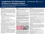Langerhans Cell Histiocytosis of Vulva in a Pediatric Patient by Sarah Pilarski, Kania McGhee, Kate Wiewiora, and Vyvian Borse-Hatchett