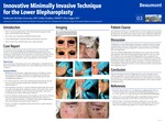 Innovative Minimally Invasive Technique for the Lower Blepharoplasty