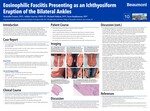 Eosinophilic Fasciitis Presenting as an Ichthyosiform Eruption of the Bilateral Ankles by Nedyalko Ivanov, Ashley Garvin, Michael Mahon, and Sean Stephenson