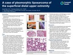 A Case of Pleomorphic Liposarcoma of the Superficial Distal Upper Extremity