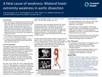 A Fatal Cause of Weakness: Bilateral Lower Extremity Weakness in Aortic Dissection