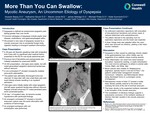 More Than You Can Swallow: Mycotic Aneurysm, An Uncommon Etiology of Dyspepsia