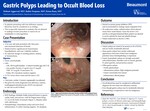 Gastric Polyps Leading to Occult Blood Loss