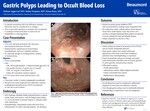 Gastric Polyps Leading to Occult Blood Loss by Nishant Aggarwal, Rabin Neupane, and Ketan Rana