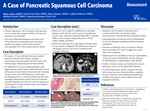 A Case of Pancreatic Squamous Cell Cancer