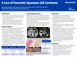 A Case of Pancreatic Squamous Cell Cancer by Bijaya Thapa, Ujjwal Jung Karki, Bipin Ghimire, Ashbita Pokharel, Shailesh Niroula, and Mohammad Muhsin Chisti