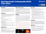 Apical Hypertrophic Cardiomyopathy: A Rare Variant of Hypertrophic Cardiomyopathies