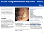 PEG Tube: Dealing With Transcolonic Misplacement