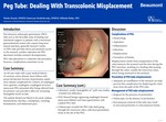 PEG Tube: Dealing With Transcolonic Misplacement by Marko Kozyk, Kateryna Strubchevska, and Mihaela Batke