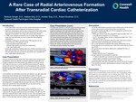 A Rare Case of Radial Arteriovenous Formation After Transradial Cardiac Catheterization by Barbara Senger, Hassan Eidy, Andrew Gray, and Robert Grodman