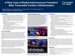 A Rare Case of Radial Arteriovenous Formation After Transradial Cardiac Catheterization