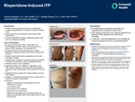 Risperidone-Induced ITP