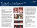 The Mysterious Case of Laryngeal TB