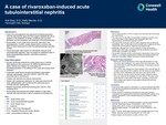 A Case of Rivaroxaban-Induced Acute Tubulointerstitial Nephritis by Kali Gray and Kelly Mercier