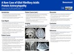 A Rare Case of Autoimmune Glial Fibrillary Acidic Protein Astrocytopathy by Jonathan Doty and Jonathan Fellows