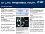 Anti-Yo Positive Paraneoplastic Cerebellar Degeneration: A Case of Discovering Fallopian Tube Cancer From Neurological Symptoms by Sydney Jacobs, Alaina Skotak, and Inna Sta Maria