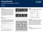 Seeing Double An Atypical Presentation of RCVS