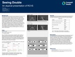 Seeing Double An atypical presentation of RCVS