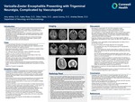 Varicella-Zoster Encephalitis Presenting with Trigeminal Neuralgia, Complicated by Vasculopathy