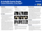 An Irreducible Posterior Shoulder Fracture-Dislocation: A Case Report