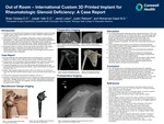 Out of Room – International Custom 3D Printed Implant for Rheumatologic Glenoid Deficiency: A Case Report by Brian Golasa, Josiah Valk, Jared Lutsic, Justin Rebock, and Mohamed Saad