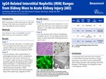 IgG4-Related Interstitial Nephritis (IRIN) Ranges from Kidney Mass to Acute Kidney Injury (AKI)