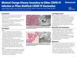 Minimal Change Disease Secondary to Either COVID-19 Infection or Pfizer-BioNTech COVID-19 Vaccination. by Ashbita Pokharel, Wei Li, Hassan D. Kanaan, Ping L. Zhang, and Neal B. Blatt