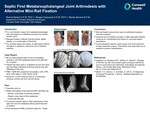 Septic First Metatarsophalangeal Joint Arthrodesis with Alternative Mini-Rail Fixation