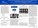 Fluoroscopic Demonstration of Thoracic Tumor Immobilization with High Frequency Percussive Ventilation