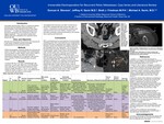 Irreversible Electroporation for Recurrent Pelvic Metastases: Case Series and Literature Review