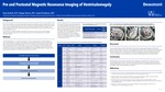 Pre and Postnatal Magnetic Resonance Imaging of Ventriculomegaly by Ryan Kelsch, Megan Moore, and Anant Krishnan