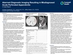 Aberrant Diagnostic Imaging Resulting in Misdiagnosed  Acute Perforated Appendicitis A Case Report