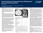 Aberrant Diagnostic Imaging Resulting in Misdiagnosed Acute Perforated Appendicitis: A Case Report