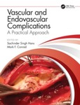 Complications of Inferior Vena Cava Filters